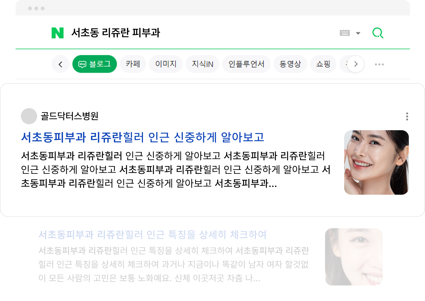 서초동 리쥬란