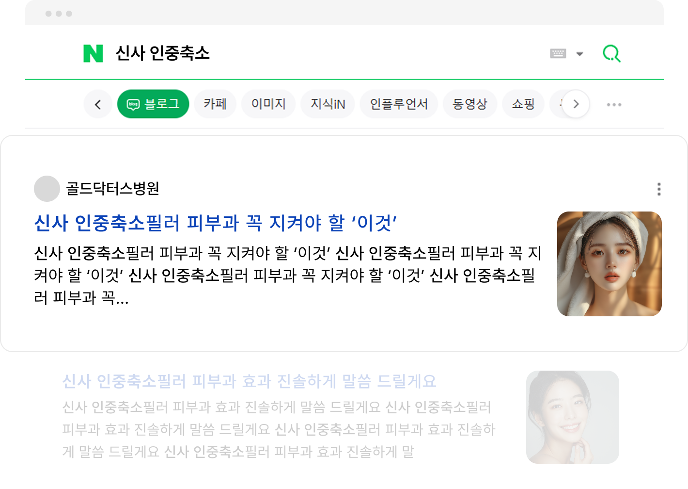 신사 인중축소