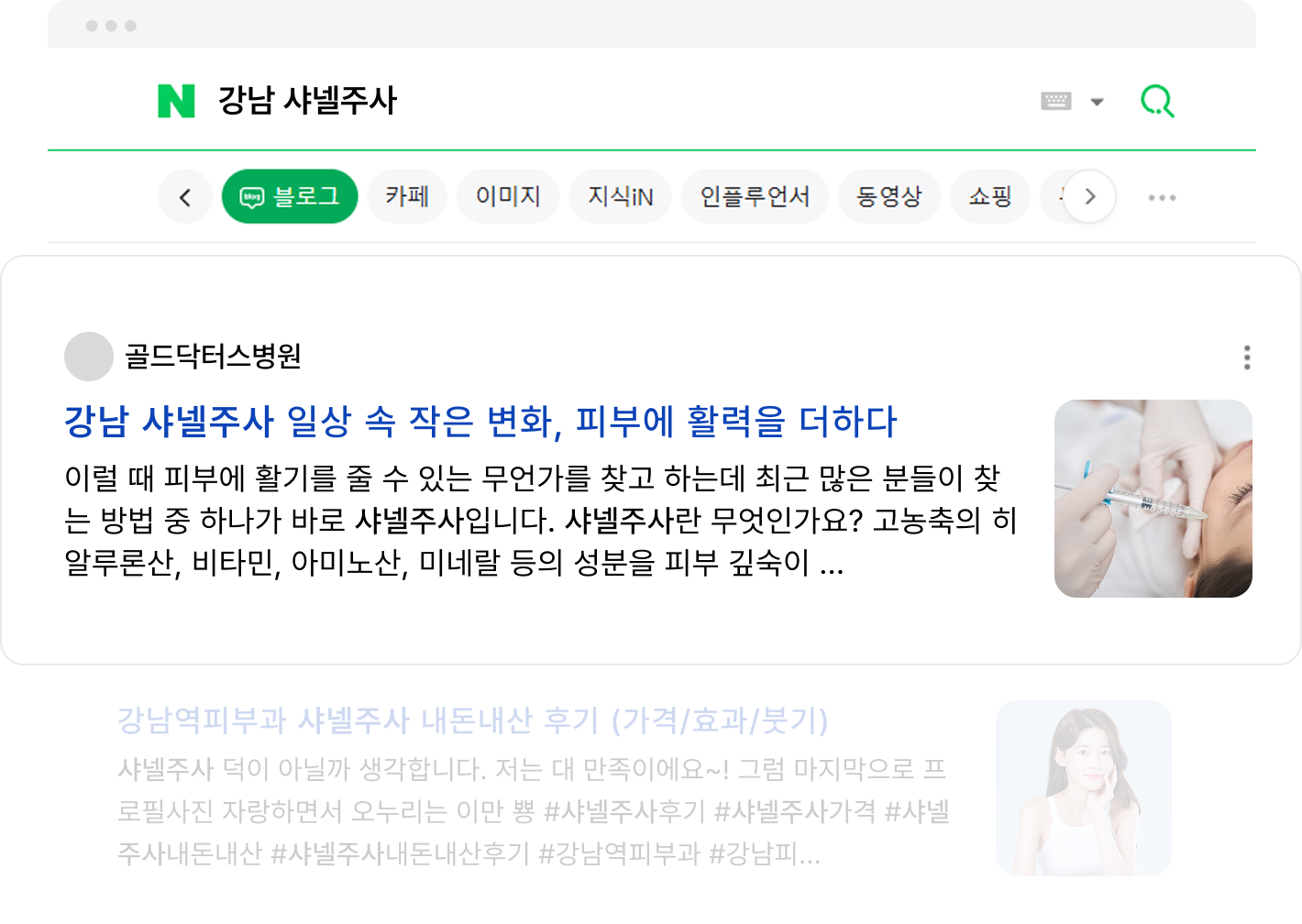 강남 샤넬주사